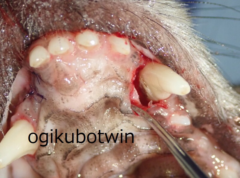 犬歯　再生治療　
